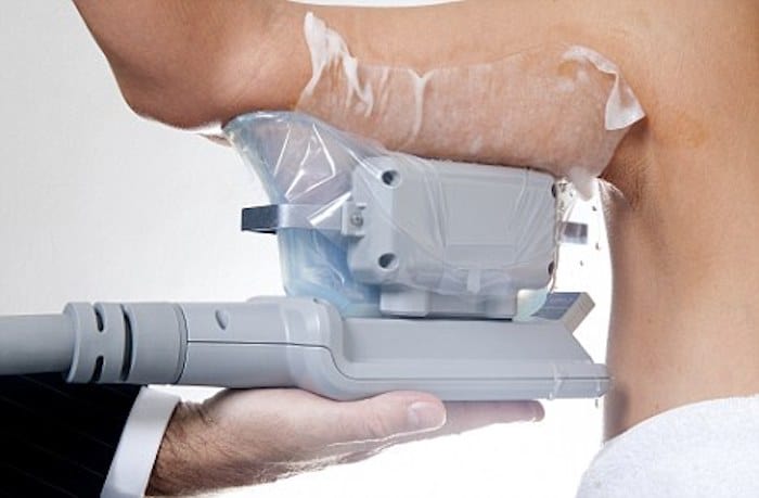 fat freezing arms Higham Ferrers