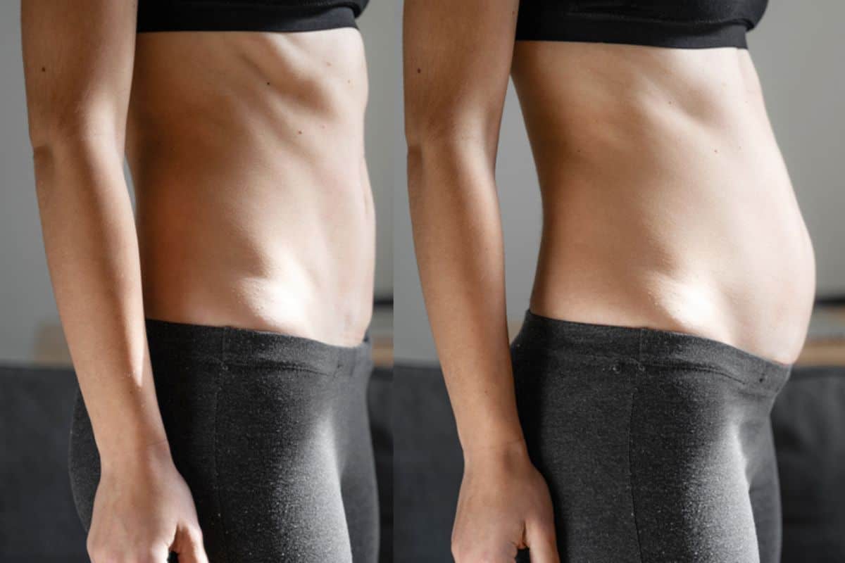 How long does diastasis recti take to improve Higham Ferrers?