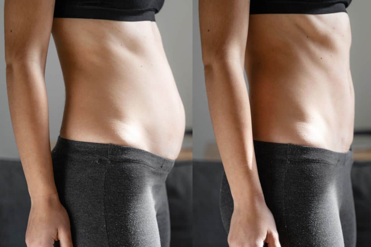 Post-Pregnancy: What Happens to Your Abdominal Muscles After Birth Higham Ferrers