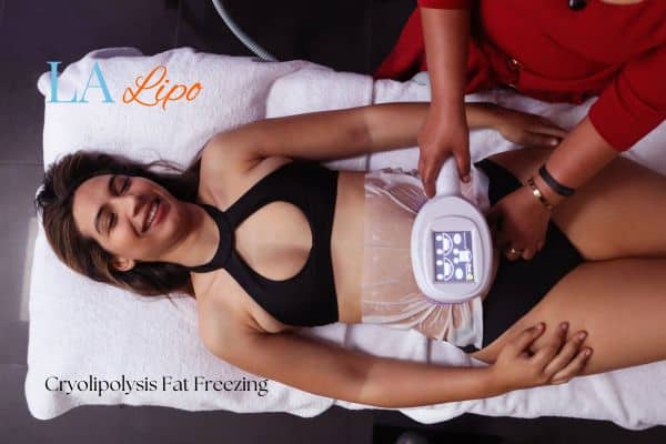 woman getting cryolipolysis Higham Ferrers