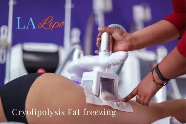 women getting fat freezing Higham Ferrers
