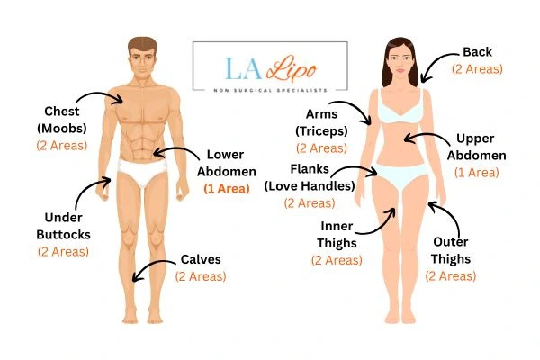 LA LIPO Cryolipolysis Areas Higham Ferrers