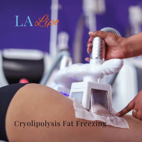 fat freezing - Cryolipolysis Higham Ferrers