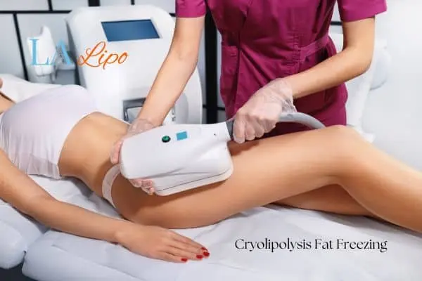 Woman receiving coolsculpting Higham Ferrers treatment on her thighs