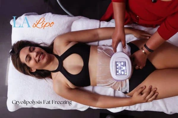 woman getting cryolipolysis Higham Ferrers