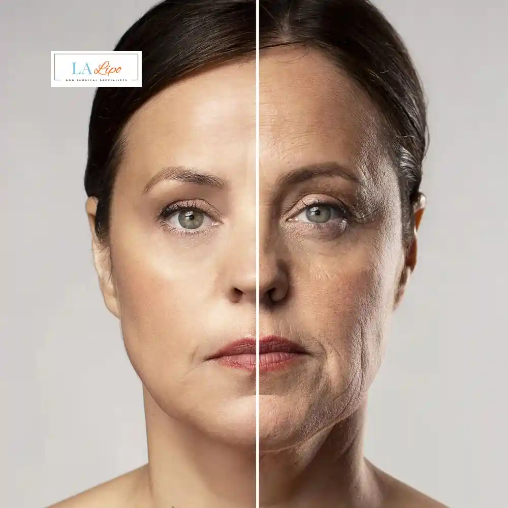 How Can You Tell If Non-Surgical Skin Tightening Is Right for You Higham Ferrers?