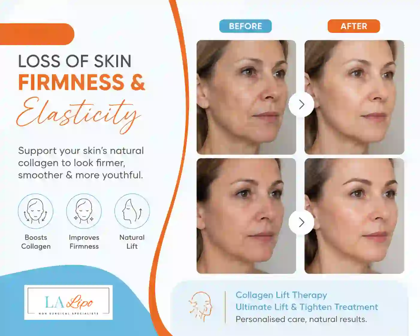 Sign #7: Loss of Skin Firmness and Elasticity Higham Ferrers
